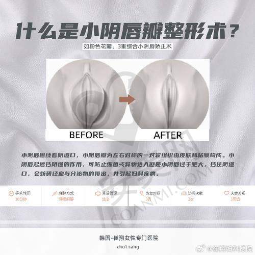 为什么选择西安画美女性私密整形医院？
