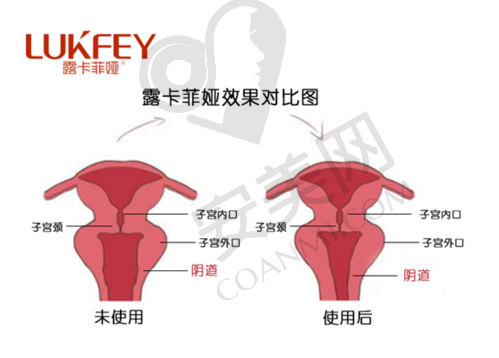西安画美整形医院阴道紧缩价格分阶情况如何？