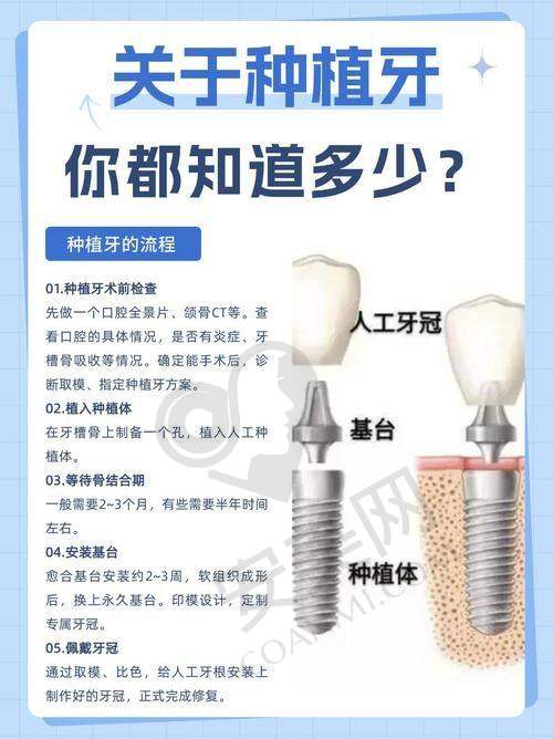珠海海精灵口腔李永平院长简介