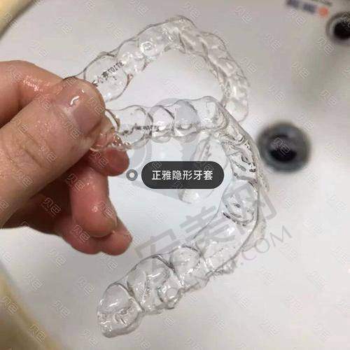 与其他品牌隐形矫正相比，正雅隐形矫正有什么不同？