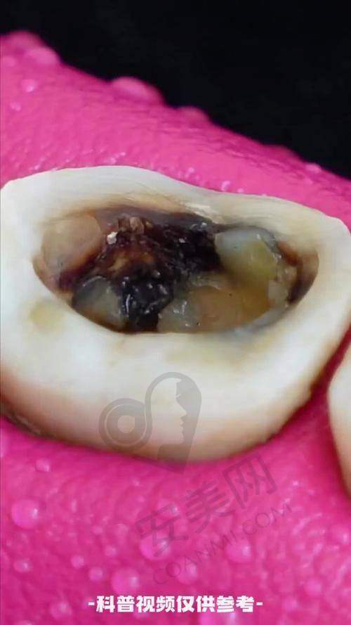 总结
