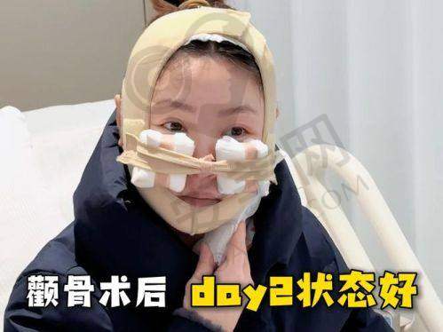 北京圣嘉新医疗美容医院磨骨的安心性有保护吗？