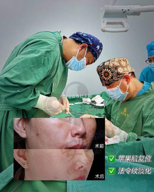 北京圣嘉新医疗美容医院磨骨骨干医生团队实力如何？
