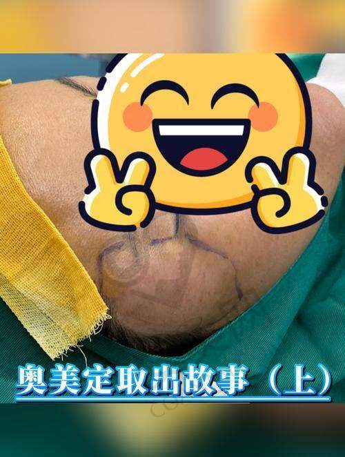 北京煤医胸部奥美定取出价格是如何分阶的？