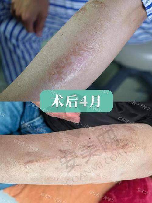 医院资质：成都军建疤痕医院是否具备正规行医资格？
