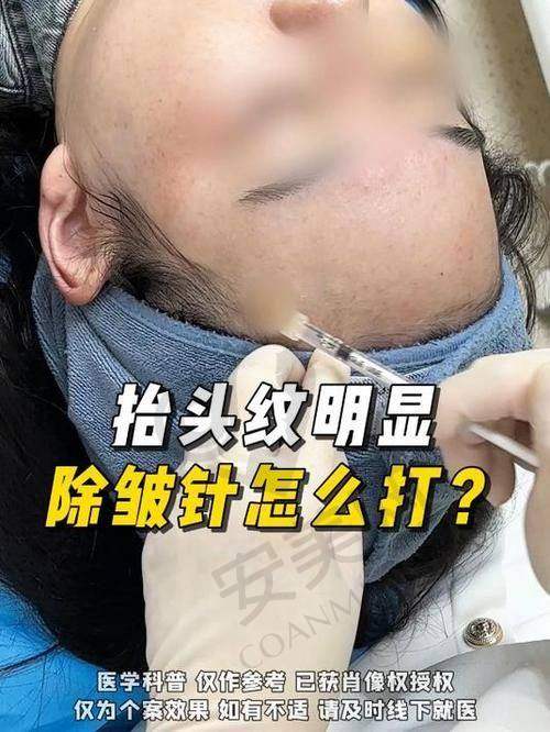 郑州壹加壹玻尿酸除皱的价格是如何确定的？