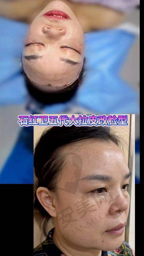 手术前的准备工作有哪些？
