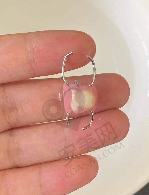 复诊与后续护理指导