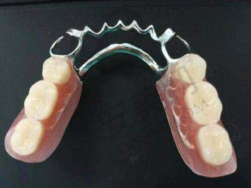 选择玉溪牙博仕口腔医院假牙的意义何在？