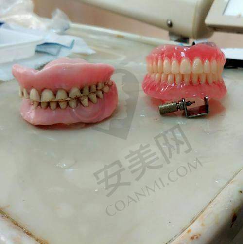 佩戴全口假牙后的感受如何？