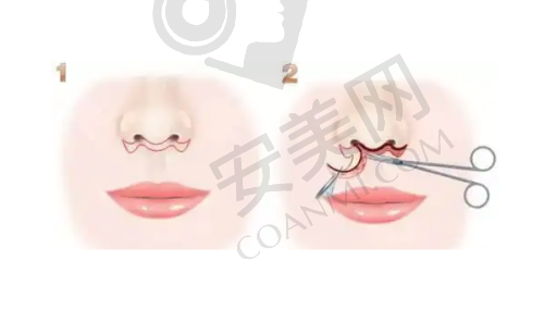 6、昆明杰西艾高丹医生预约挂号指南