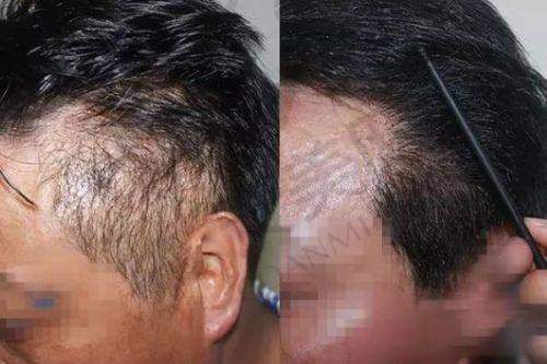 南京新生植发医院医生介绍