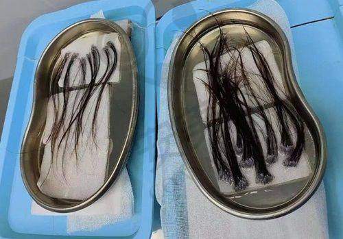 南宁华美整形医院地址的优势体现在哪？
