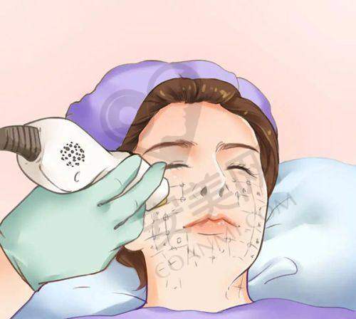 北京丽合热玛吉抗衰的服务体验如何？