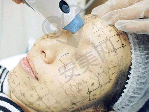 北京丽合热玛吉抗衰的医生水平怎么样？