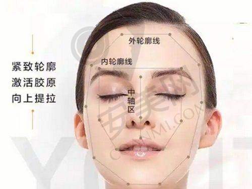 大连雅婷医院双眼皮整形术后成效有保护吗？
