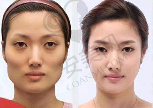 二、中山爱汇星医疗美容医院正规吗？