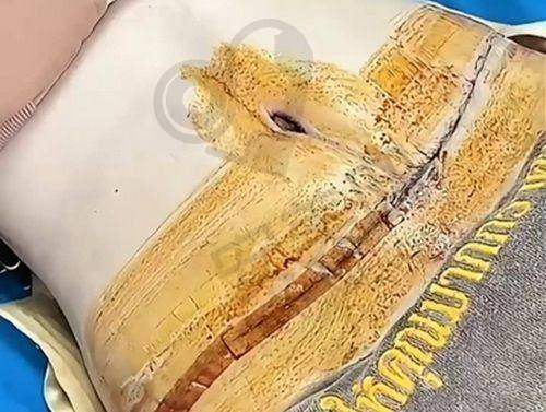 天津爱丽诺医疗美容医院预约挂号流程：