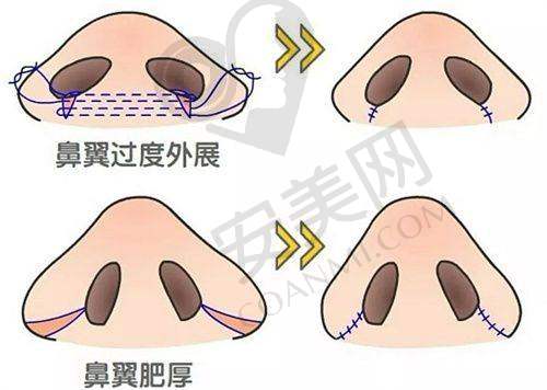 北京八大处医院收费受哪些因素影响？