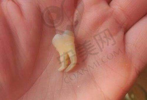 常州固德熊猫口腔黎万洲牙医生种植牙怎么样？