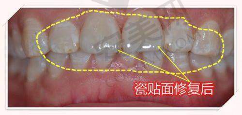 揭阳诺贝尔口腔医院是揭阳最大的口腔医院吗？35台牙椅+双CBCT机给出答案 