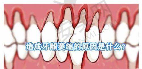 瑞士ITI瑞锆种植牙8980元起是怎么回事？