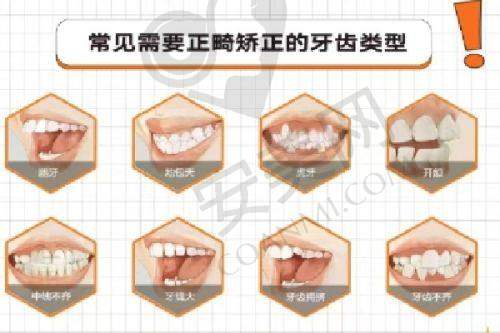 济南好牙口腔马跃医生牙齿矫正怎么样？