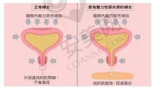患者的真实反馈与实例展示