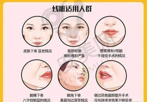 3、长春中妍赵胜有医生整形技术怎么样？