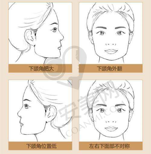 就诊过程是怎样的？