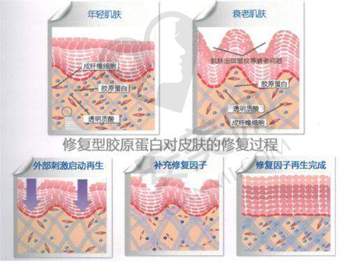 西安艺星医院玻尿酸轮廓固定的价格是如何确定的？