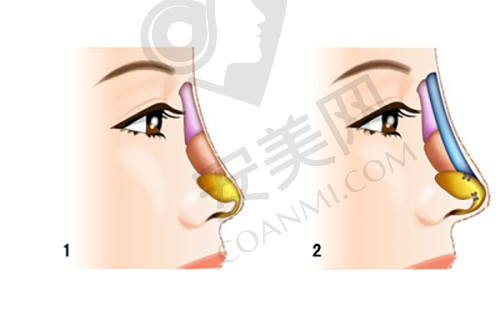 北京俊泰美好鼻综合整形的技术特色有哪些？