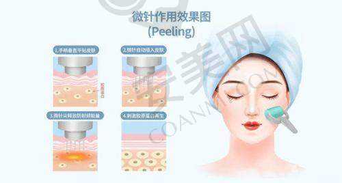 北京俊泰美好鼻综合整形值得尝试吗？