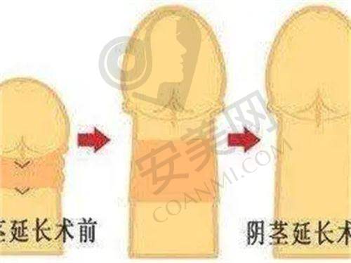 北京八大处外科修复手术收费是怎样的？