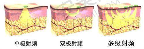 昆明杰西艾整形外科医院预约挂号流程：