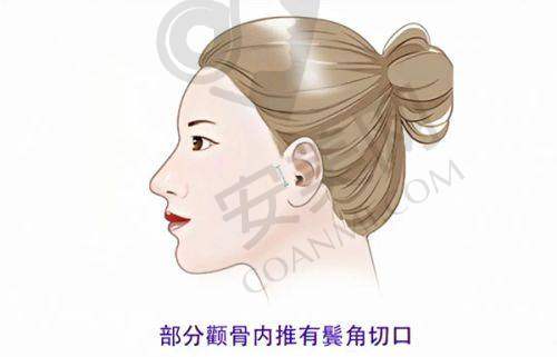 南宁华美整形医院地址的稳定性如何？