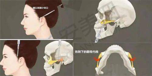 1、天津爱丽诺闫腾元医生怎么样？
