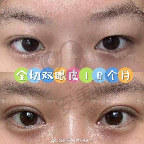 总结与建议