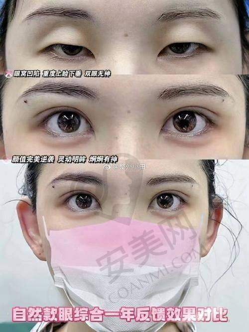 青岛诺德整形医院为林建新医生做双眼皮修复提供了哪些支持？