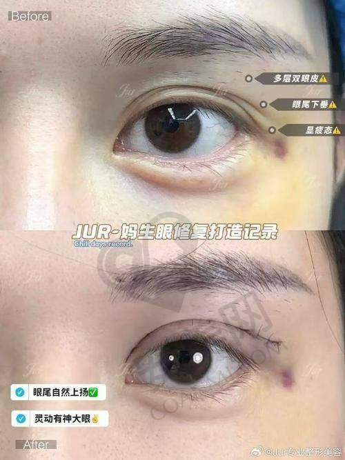 独特的手术技术与审美理念