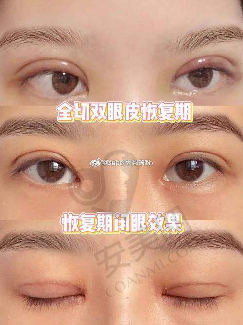 陈小剑院长：眼部整形界的从业多年骨干医生