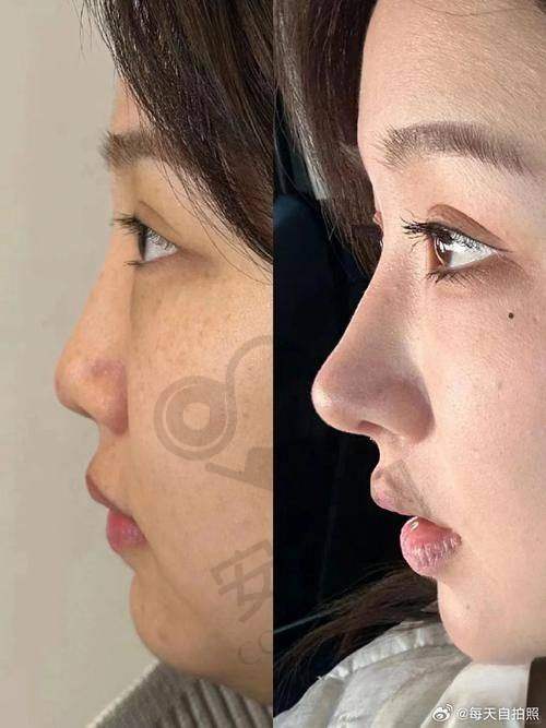 戴传昌：网红整形医生