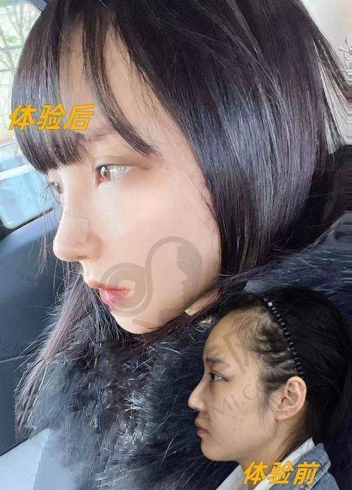 陈付国：值得信赖的鼻整形骨干医生