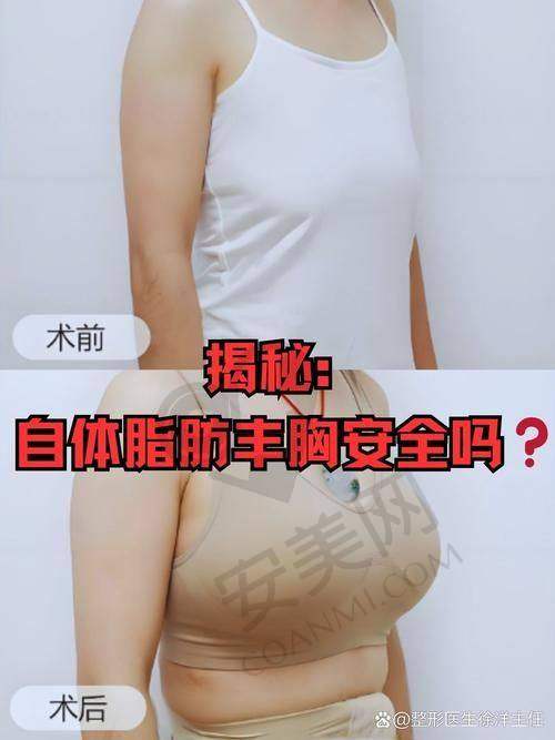 赣州亚韩吴礼诚降胸价格受哪些因素影响？