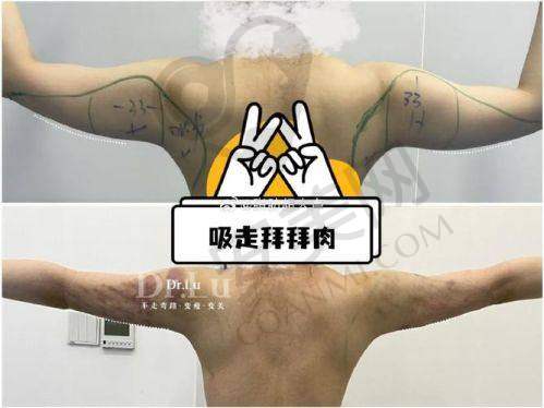 成都怡脂在哪里？怎么去呢？