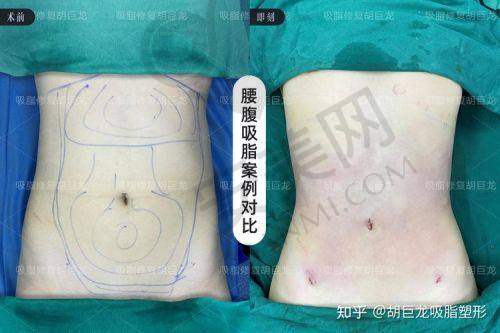 长沙雅美医院的服务有哪些特色？