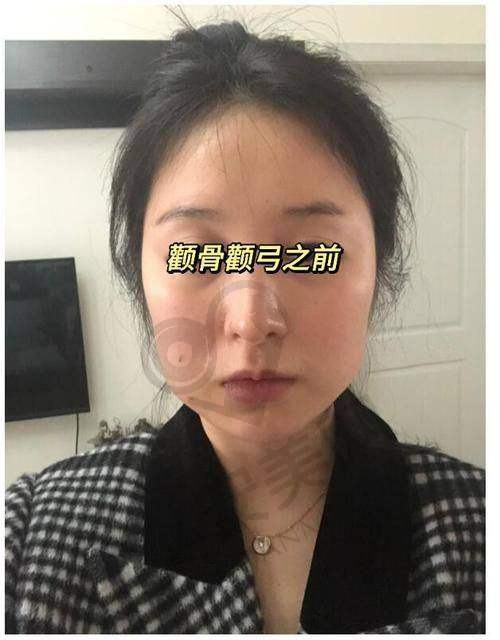 术后修复，耐心等待美丽绽放