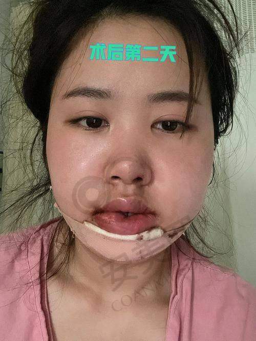 结语
