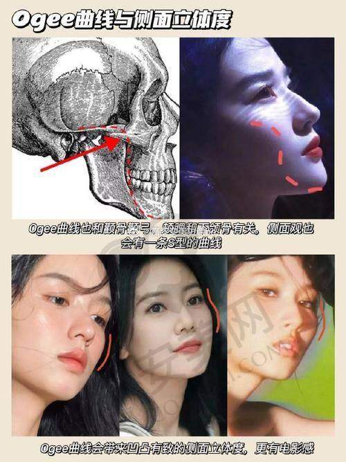 重庆松山医院磨颧骨手术的实例成效如何？