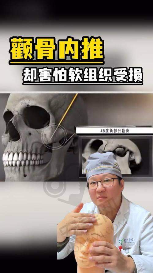 磨颧骨手术有哪些风险和注意事项？